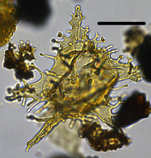 Apectodinium parvum PApa30X14143220975c.jpg